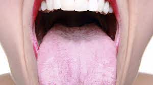 You may undergo a physical exam. Hpv Traced To Growing Number Of Oral Cancers Wbfo