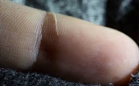 This works best because when you apply hydrogen peroxide the area. How To Remove Ultra Fine Aluminum Swarf Chips Slivers