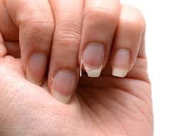 Un Super Soin Reparateur Et Fortifiant Fait Maison Pour Les Ongles Astuces De Grand Mere Reparer Un Ongle Casse Soin Des Ongles Avoir De Beaux Ongles