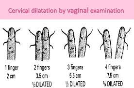 What Does 1 Cm Dilated 50 Effaced Mean New Health Advisor