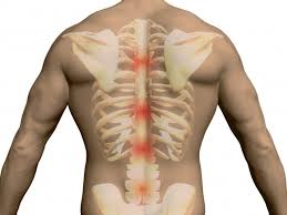 The exact location of the pain is a key indicator of its cause. Thoracic Spine