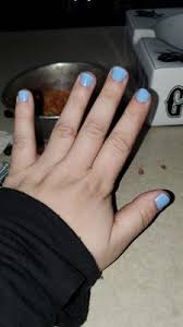 That being said, the vitamin deficiency must be severe before you start to see dry and rough skin around nails. Onyx Professional Stop The Bite Nail Biting Deterrent And File 0 5 Fl Oz Walmart Com Walmart Com