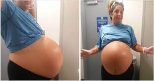 Mom S Belly Looks Like It S About To Pop Gives Birth To Biggest Baby Doctors Had Ever Seen