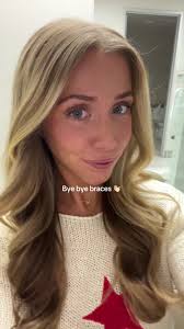 Anyone sick of the braces transitions yet?? 😁😁 #adultbraces  #bracestransformation #bracestransition #lifeontiktok #tiktokpartner