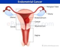 Women in their late 30s and early 40s may also experience heavy bleeding between periods. Are There Any Symptoms Caused By Uterine Cancer Quora