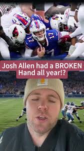 Josh Allen Breaks Fingers