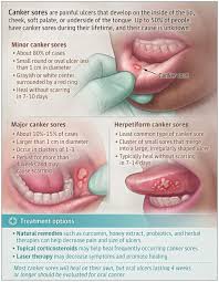 Image result for Canker sores symptoms roof of the mouth
