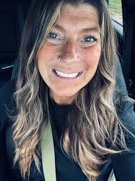 Full mouth extraction and denture placement experience