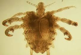 Image result for pubic lice symptoms