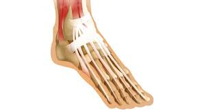 Its unique design allows the foot to handle hundreds of tons of force every day. Extensor Tendonitis Tendinopathy Symptoms Causes And Treatment