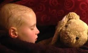 Young girl lost hair allegedly after using Wen hair products