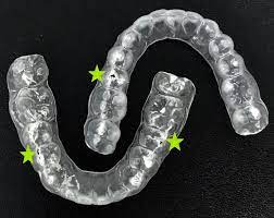 Dental Braces Singapore Retainer Issues Mybracesclinic