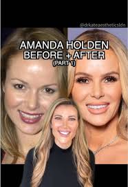 Amanda Holden Gp Surgery