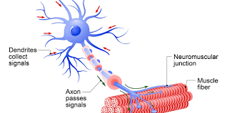 spinal muscular atrophy ile ilgili görsel sonucu