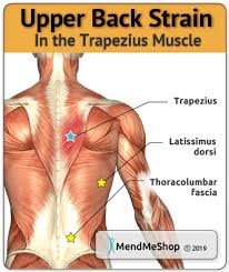 It is a large, flat muscle on the back that stretches to the sides, behind the arm, and is partly covered by the triceps are muscles in the back of the upper arm. Trapezius Strain