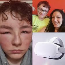 Um presente de Natal que acabou rendendo uma situação bem desagradável...  Nesta semana, um menino de 13 anos foi parar no hospital após usar óculos  de realidade virtual. Segundo o Daily Mail,