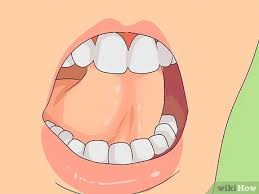 When to see a doctor. How To Gleek Wikihow