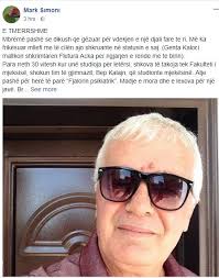 Poetja u gëzua se i vdiq djali Flutura Açkës, shkrimtari: Ndjej neveri t'ia  përmend emrin, sa i madh është djalli