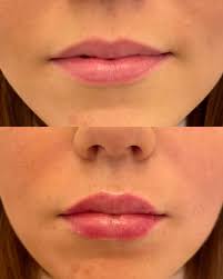 Aesthetics by Georgia