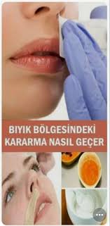Biyik Bolgesindeki Kararma Nasil Gecer Saglikli Cilt Bakimi Dogal Cilt Bakimi Dogal Guzellik Ipuclari