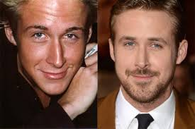Franklin rose meet a texas woman undergoing eight plastic surgical procedures to look like the famous vice. These Male Celebrities Have Proved To The World That Plastic Surgery Is Not Just A Female Game Eminetra South Africa