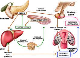 Obesity As Disruptor Of The Female Fertility Reproductive Biology And Endocrinology Full Text