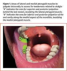 Image result for Otalgia