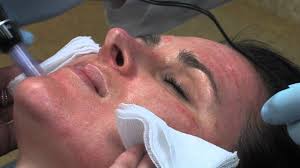 Rejuvenate, and refresh your skin. Laser Wrinkle Treatment Laser Skin Resurfacing Laser Peels Fraxel Fractional Skin Resurfacing Salt Lake City Utah