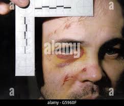 Liam mccotter hi-res stock photography and images