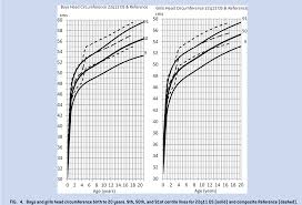 figure 4 from syndrome specific growth charts for 22q11 2