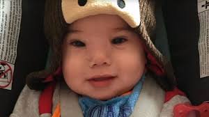 'Hidden Beauty' Unveiled After Large Mass Removed from Baby with Rare Birth  Defect