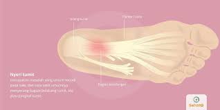 Maybe you would like to learn more about one of these? Nyeri Tumit Tanda Dan Gejala Penyebab Cara Mengobati Cara Mencegah