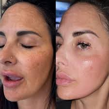 Wait... that's just skincare? As one of the top three ZO Skin Health  providers in Northern New England, we've made it our mission to address  every skincare and anti-aging concern with tailored