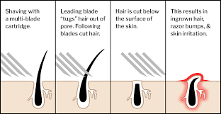 You may not realize it, but razors don't just simply cut when they pass over your face. Shave In Direction Of Hair Growth