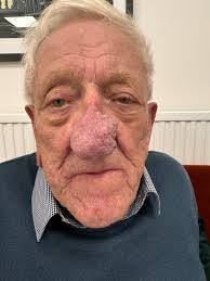 A pint leads to a amazing transformation for Irishman