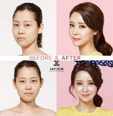 How much are household products in south korea? 17 Koreanische Plastische Chirurgie Ideen In 2021 Plastische Chirurgie Nasenkorrektur Prominente Plastische Chirurgie