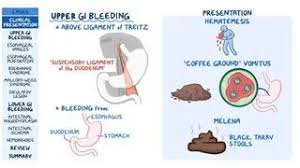 Image result for Small Intestinal Bleeding