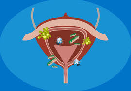 Maybe you would like to learn more about one of these? Why Do I Get Utis So Often Health Essentials From Cleveland Clinic