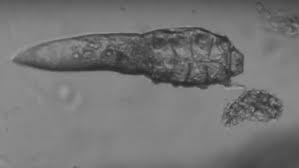 Image result for Demodex brevis