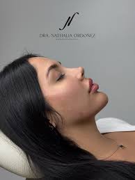 Galier 🏛️ Armonización Orofacial (@galier__) • Instagram photos and videos