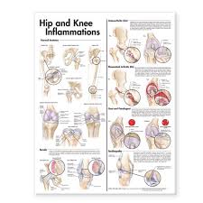 pdf download hip and knee inflammations anatomical chart pdf