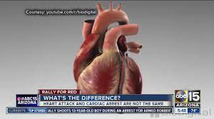 Sudden cardiac arrest is a situation that occurs when the heart suddenly stops beating effectively and blood is not circulated by the heart; What S The Difference Between Cardiac Arrest And A Heart Attack Youtube