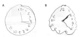 Image result for Clock Drawing Test