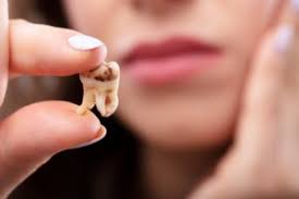 There are usually one or more warning symptoms that a tooth nerve is dying. Dentist Signs Of A Dead Tooth North Jacksonville Complete Dentistry