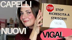 BASTA RICRESCITA A STRISCE, PRURITO E COLORE FINTO: COME HO AVUTO CAPELLI  NUOVI E MORBIDI CON VIGAL