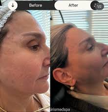 It's worth it 🥰🥰 so beauti