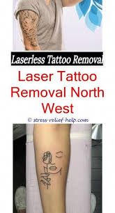 Dermabrasion is a surgical method of tattoo removal that involves the use of a medical grinding tool that is used to remove the outer layers of the skin in a controlled manner. Laser Tattoo Entfernung In Meiner Nahe Wie Viel Kostet Eine Tattoo Entfernung Laser Maschine Entfernung Tattoo Removal Cost Laser Tattoo Tattoo Eraser