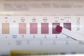 Urine Test Strips Color Chart Meaning Www