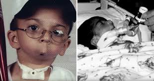 Isaiah Acosta was born without a jaw