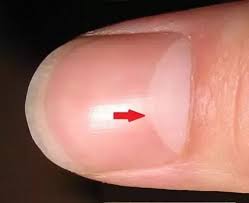 Meaning of the Half-Moon Shape On Your Fingernails -